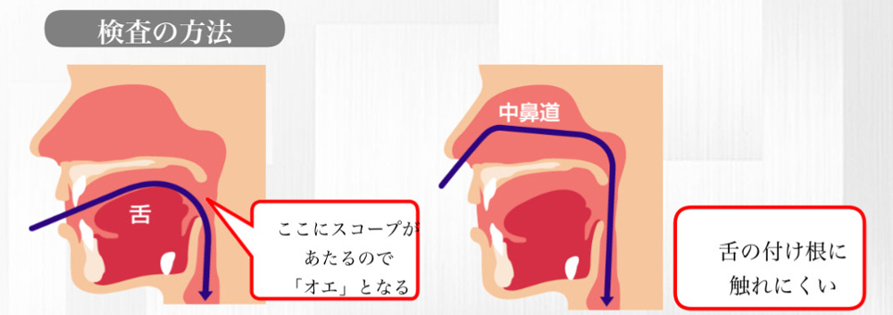 検査の方法